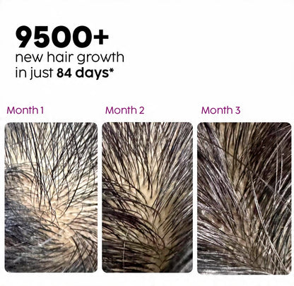 Extreme Hair Growth Serum 100 ML